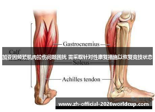加亚因频繁肌肉拉伤问题困扰 需采取针对性康复措施以恢复竞技状态
